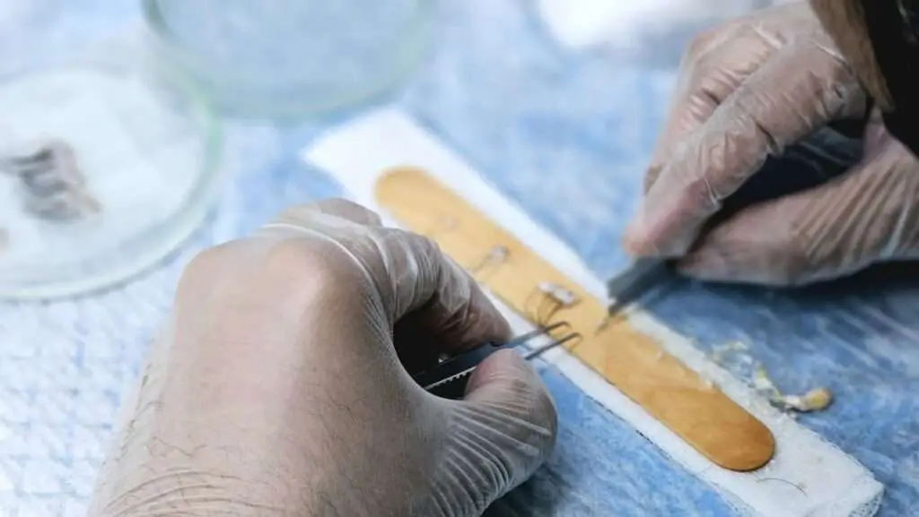 hoe werkt haartransplantatie