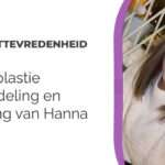 Rhinoplastie beoordeling en ervaring van Hanna