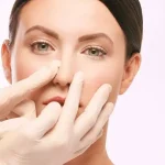Bereik Uw esthetische wensen met onze behandelingen