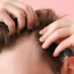 Is haartransplantatie verboden volgens de Islam? Een diepgaande analyse