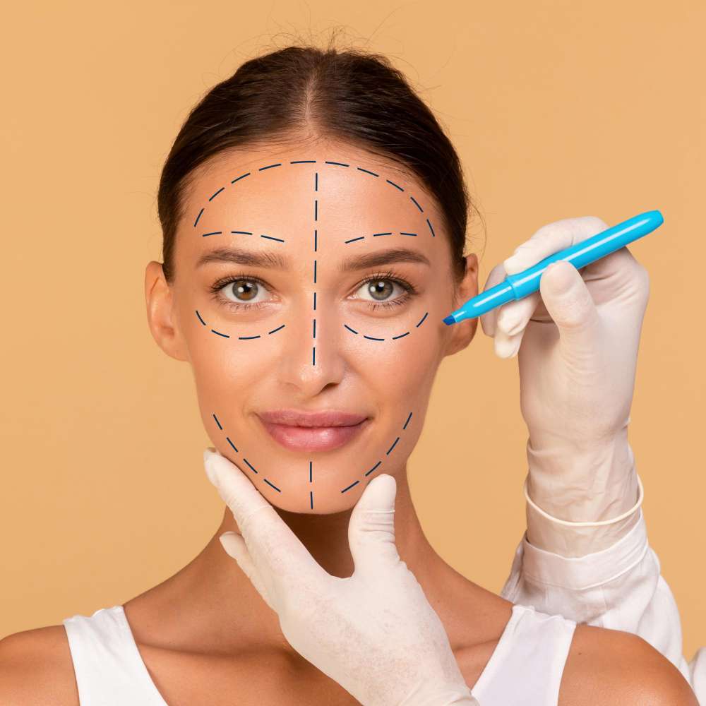 Facelift