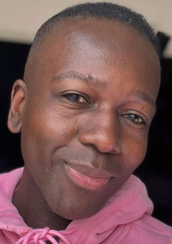 haartransplantatie-kroeshaar