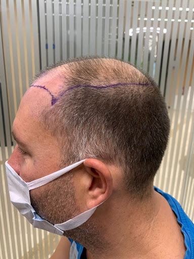 Photo from customer review