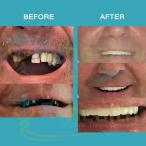 before-after-dental-treatments-09