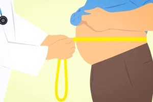 liposuction